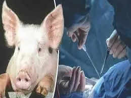 US FDA likely to okay clinical trials for pig-to-human organ transplants