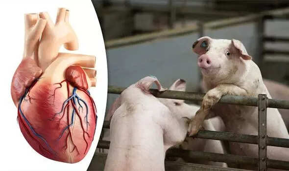 Pig-to-human heart transplant in brain dead patients successful