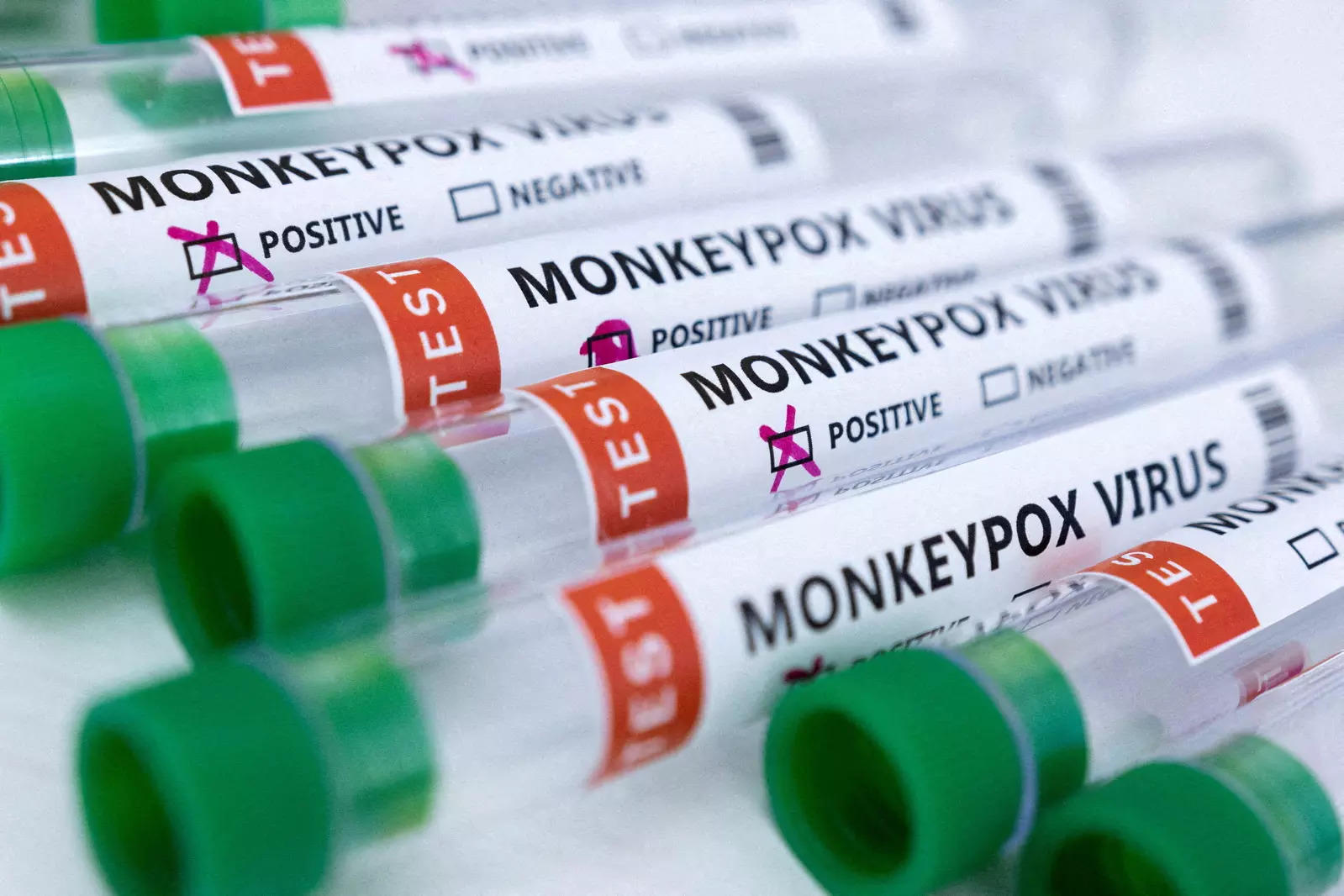 Lok Nayak declared nodal centre as Delhi on alert for monkeypox
