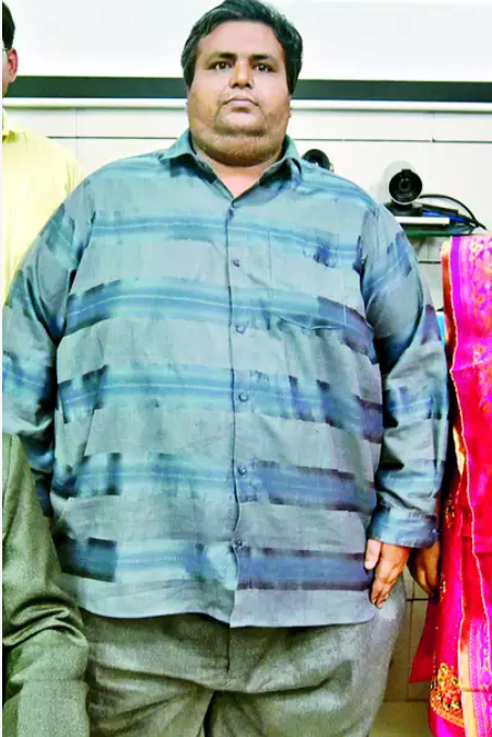 210-kg man gets bariatric surgery at A’bad hospital