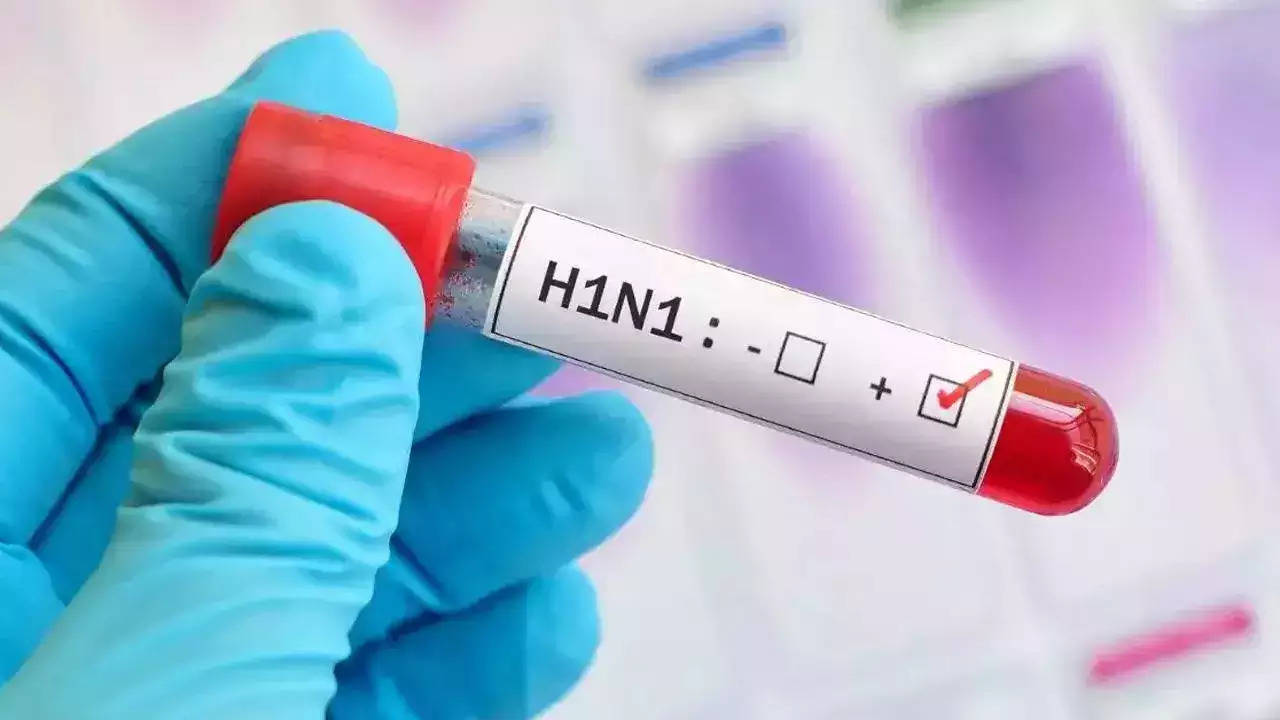 Nagpur: AIIMS among 15 nodal centres for H1N1 study