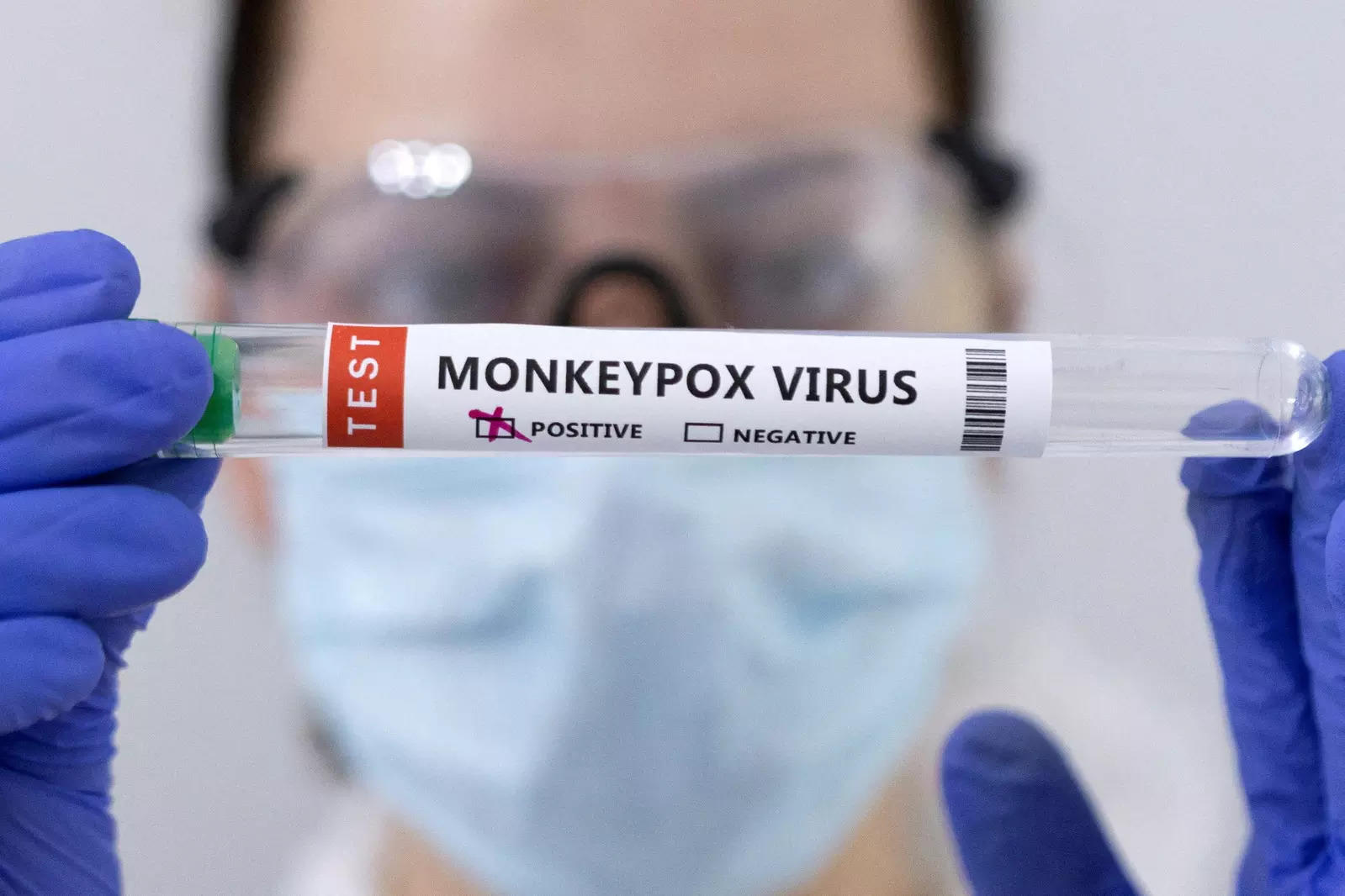 کارگردان می گوید جیپمر به زودی آزمایش ویروس آبله میمون را آغاز خواهد کرد