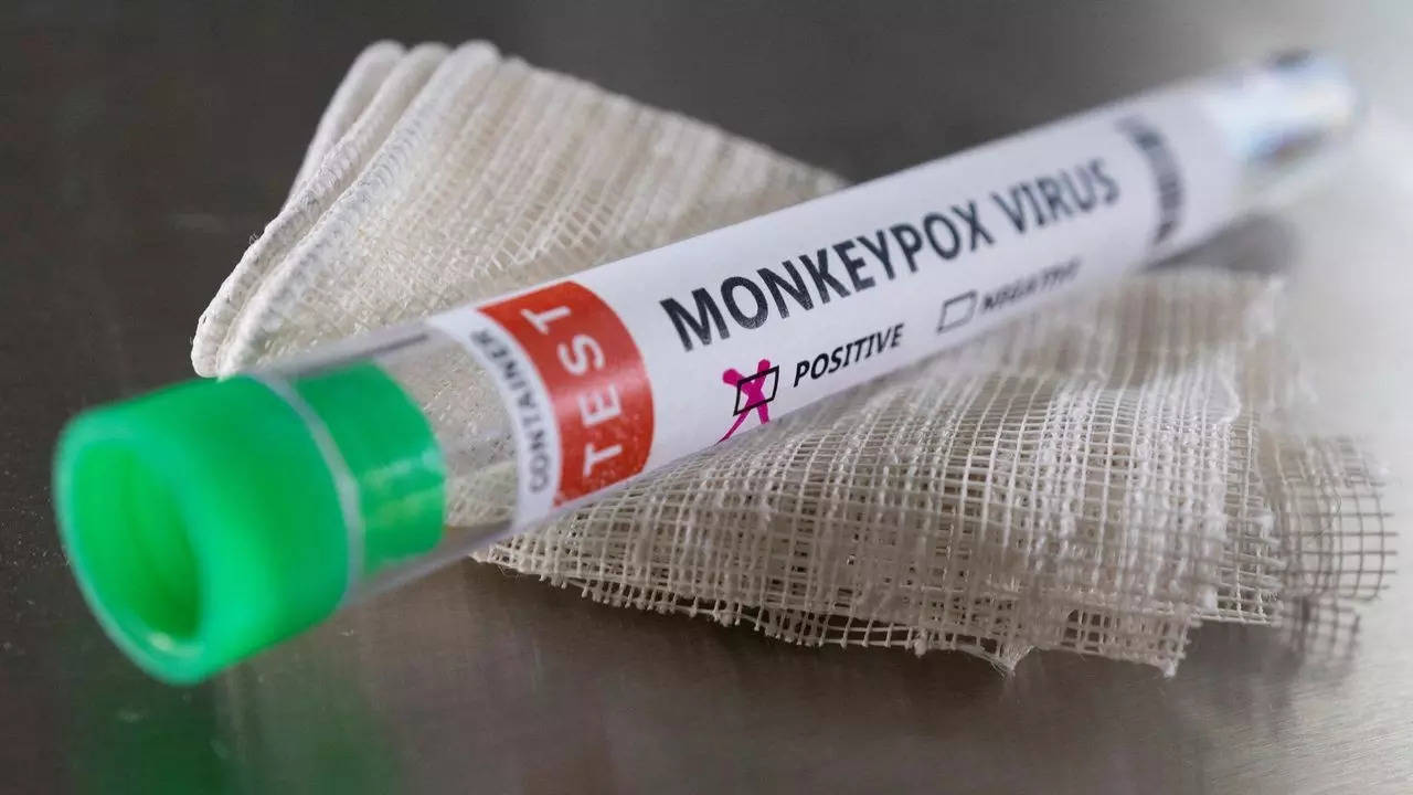 Belgium records first monkeypox death