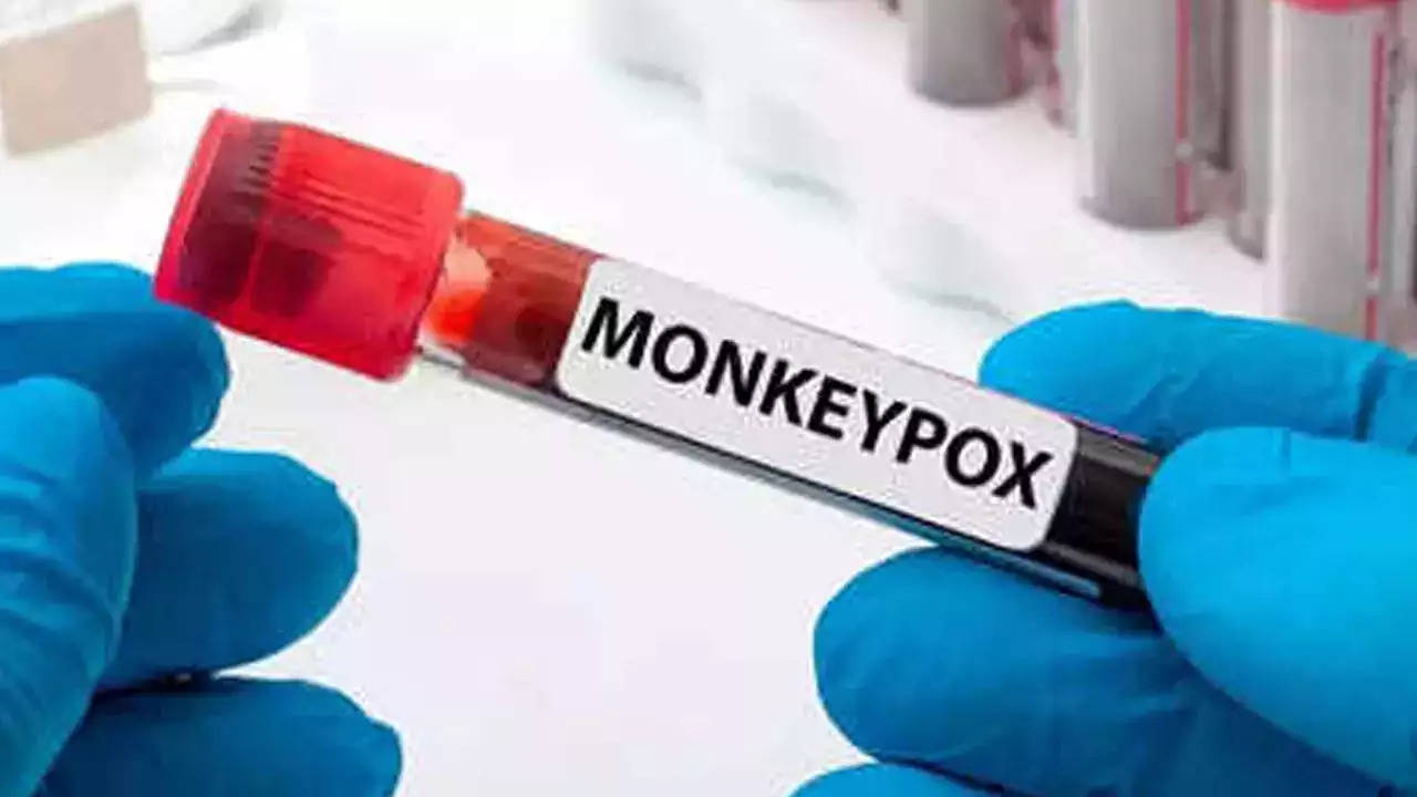 دومین مرگ آبله میمون در ایالات متحده به عنوان ویروس مرتبط با التهاب مغز