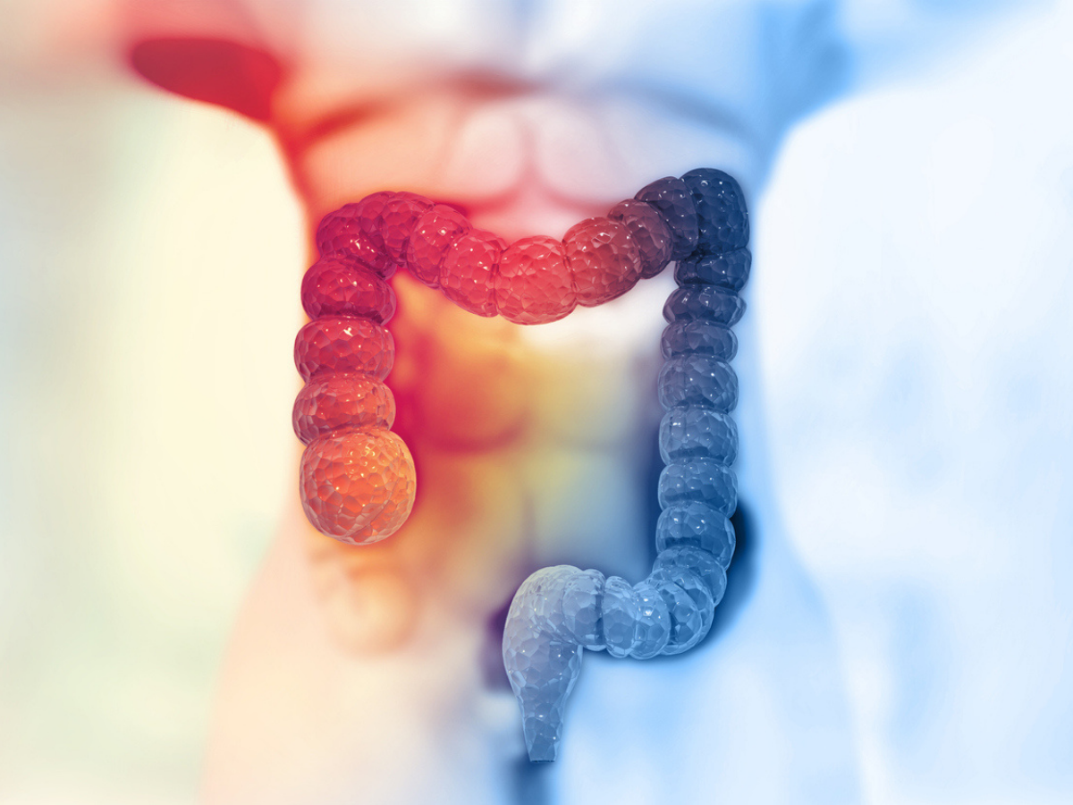 Indian experts develop way for early detection of colon cancer