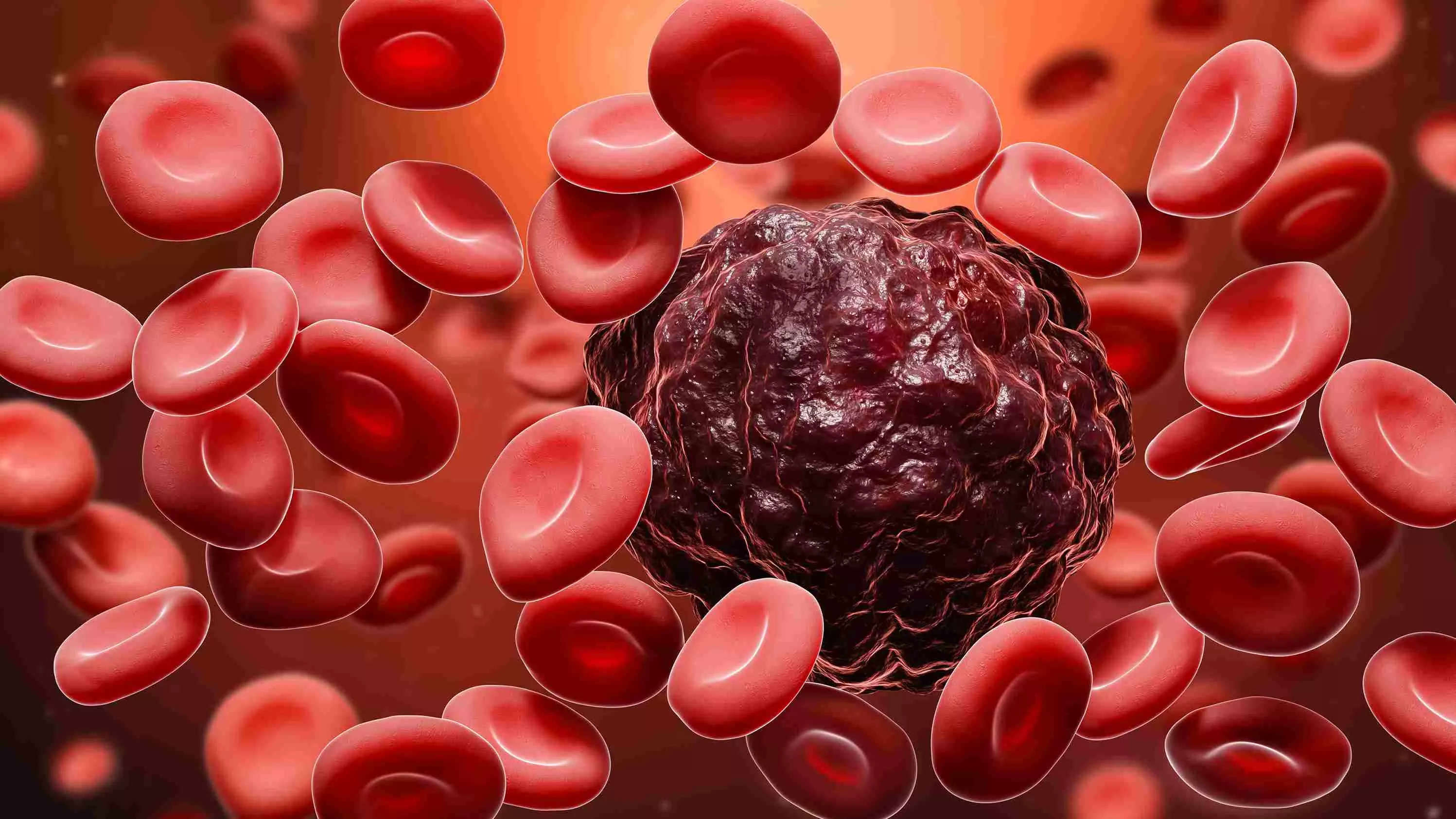 Johnson & Johnson's blood cancer therapy gets U.S. FDA approval