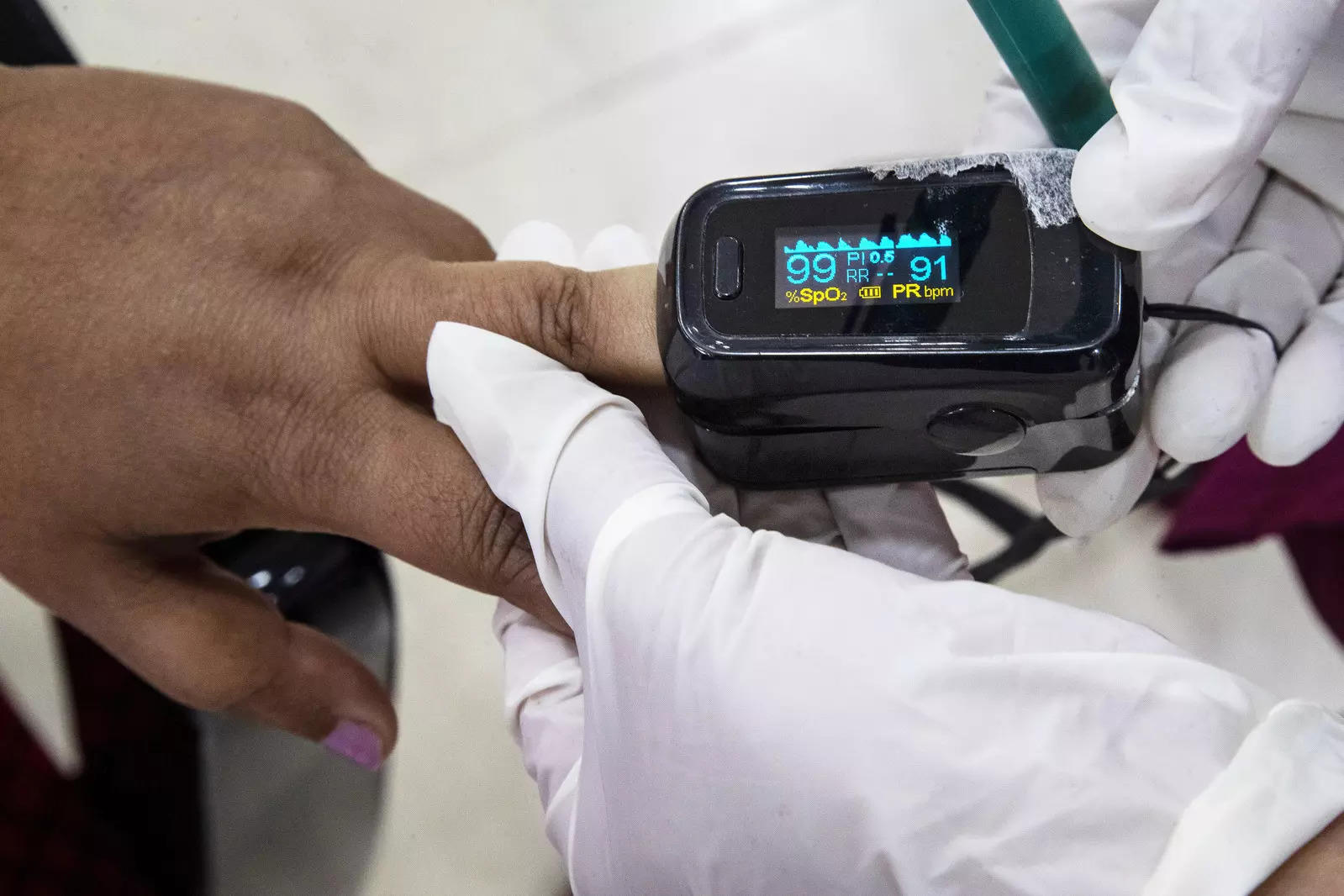 Blood oxygen monitors don't work as well on people with darker skin: FDA