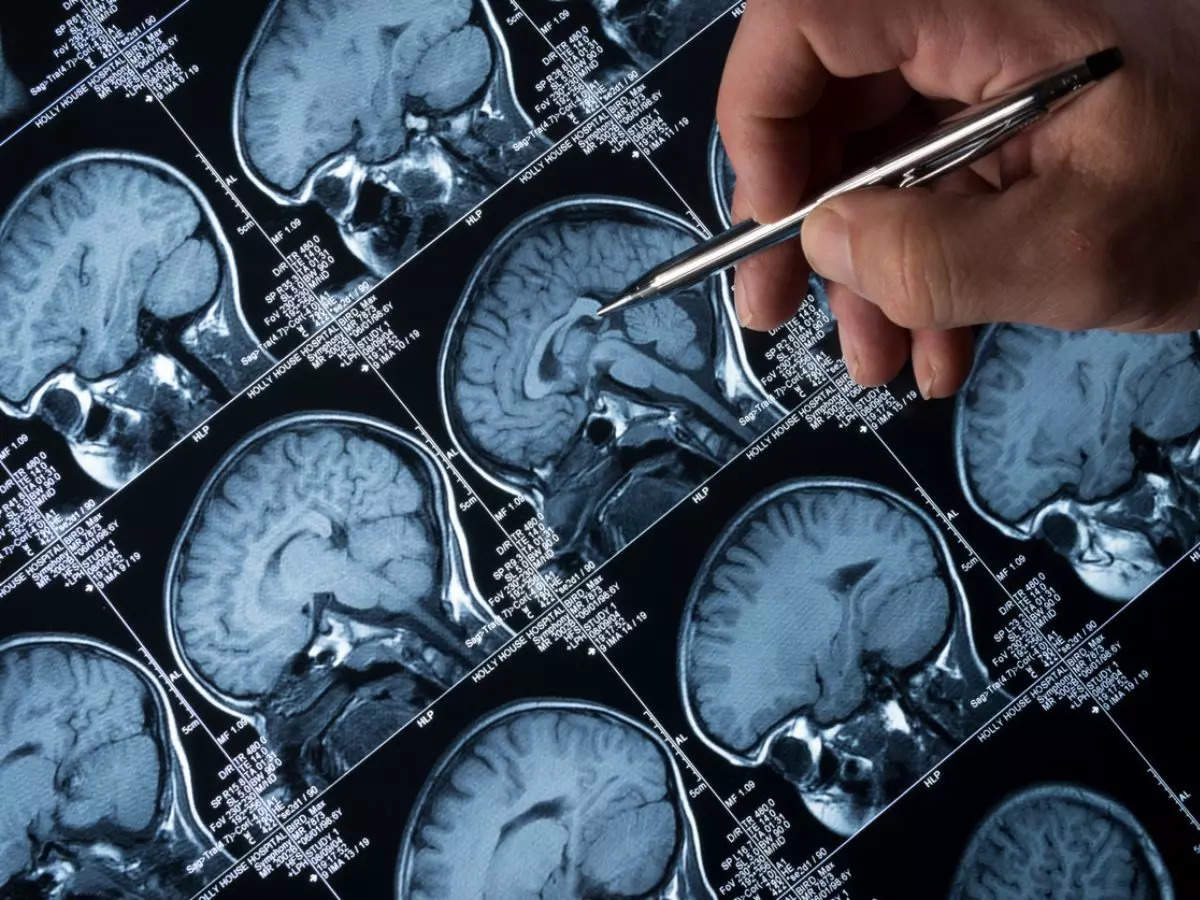 Roche's Alzheimer's drug fails to meet goal in long awaited trial