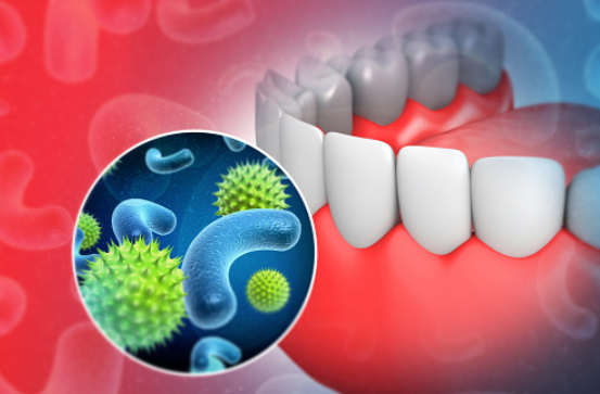 Scientists discover harmful oral bacteria that cause other diseases