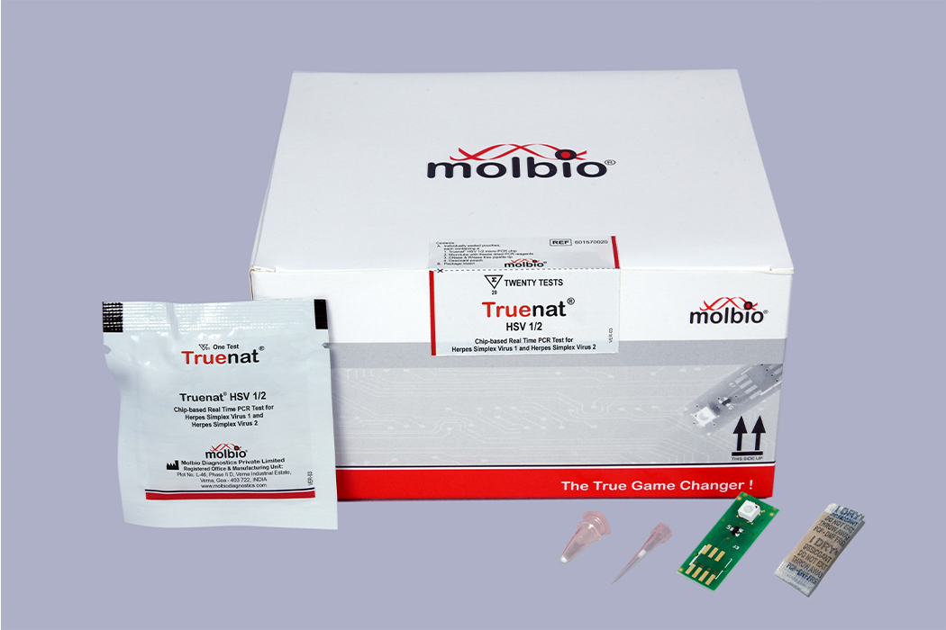 Molbio Diagnostics launches Truenat HSV 1/2 test for herpes