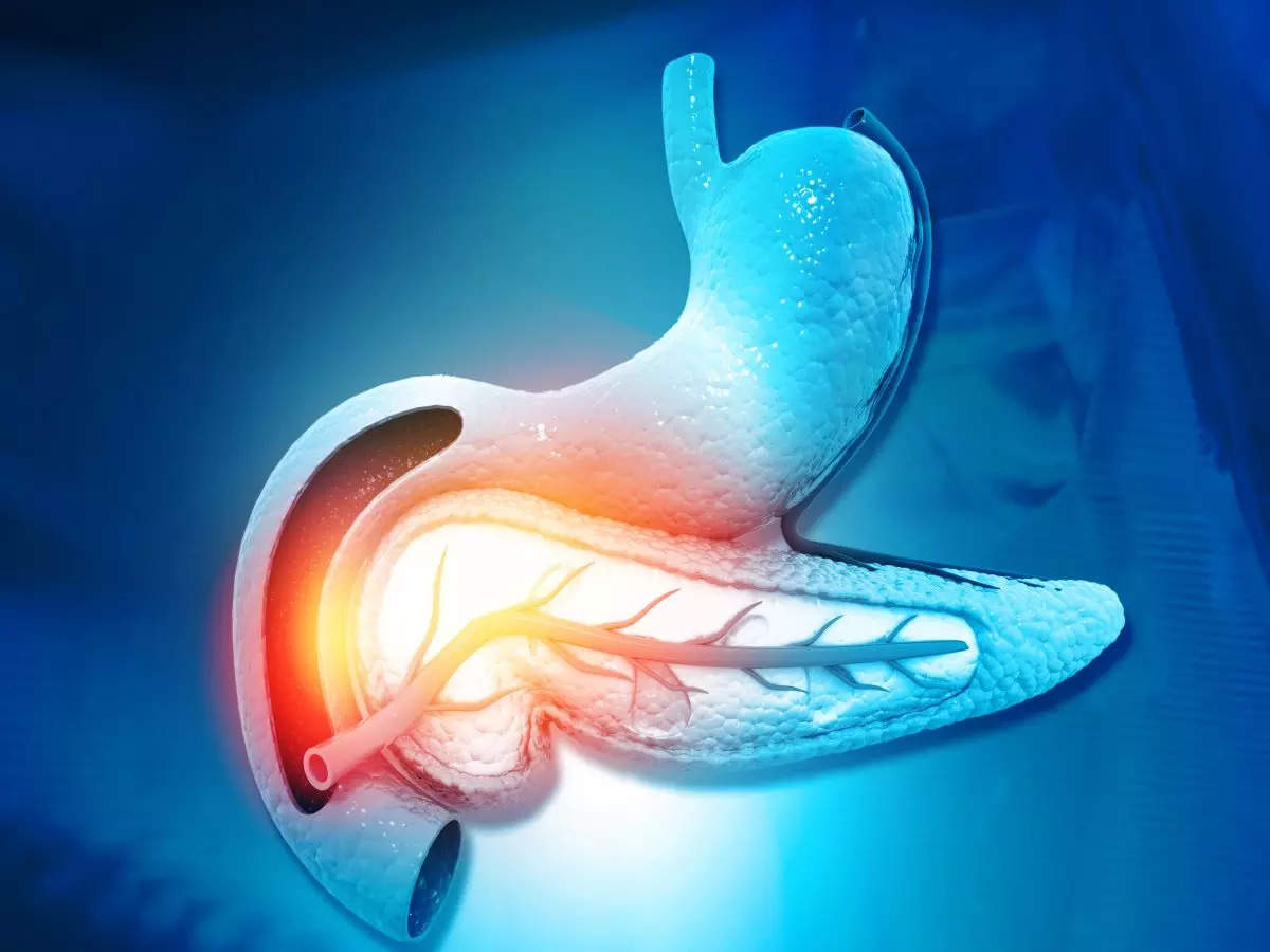 Tumor initiation in pancreatic cancer driven by stress-tolerant cells: Study