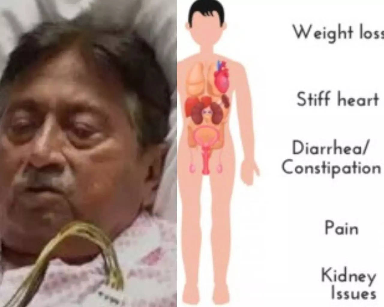 Former Pakistan President Pervez Musharraf died battling ‘amyloidosis’, a rare disease