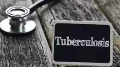 Haryana health dept ties up with private hosps to intensify tuberculosis screening in Gurgaon