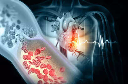 ignorance towards ncds spurts the risk of cardiac diseases
