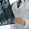 Duration of depression may impact severity of brain changes, study finds