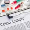 Experimental blood test finds high-risk colorectal lesions before cancer develops