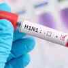 H1N1 dominates flu strains in India, accounts for 3 out of 4 cases: WHO