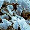 Siberia's 'mysterious illness': All about bubonic plague, how it spreads and whether the world should worry