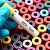 India Must Shift to HPV DNA-Based Screening to Eliminate Cervical Cancer: Dr Neerja Bhatla
