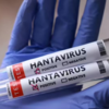 One Canadian tests positive for hantavirus, officials say