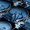 Scientists develop AI-based framework to show how distinct parts of brain age