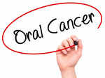 study puts productivity loss due to oral cancer in india in 2022 at usd 5 6 billion