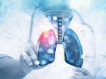 fda approves j amp j s combination therapy for a type of lung cancer