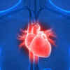 Cardiac medication sales shoot up 50% in five years