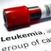 India accounts for 70% of South Asia’s childhood leukaemia cases: Study