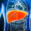 Liver cancer to double worldwide, most of it preventable: study