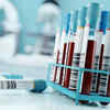 Blood test can predict lung cancer 5 years before diagnosis