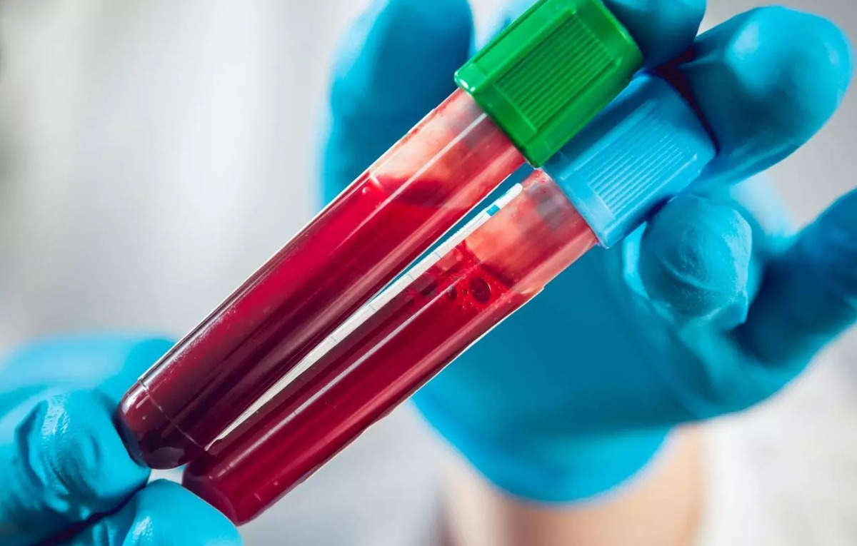 Researchers develop simple blood test to quickly diagnose sarcoidosis - ETHealthWorld