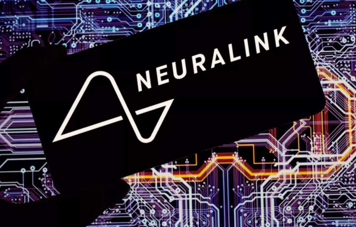 Musk’s Neuralink has faced issues with its tiny wires for years, sources say – ET HealthWorld