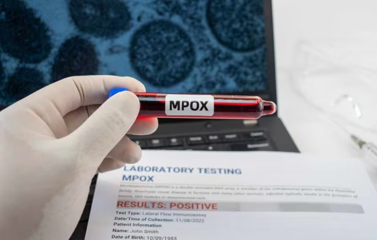 Germany Identifies Its First Case Of New Mpox Variant, Health News, ET ...