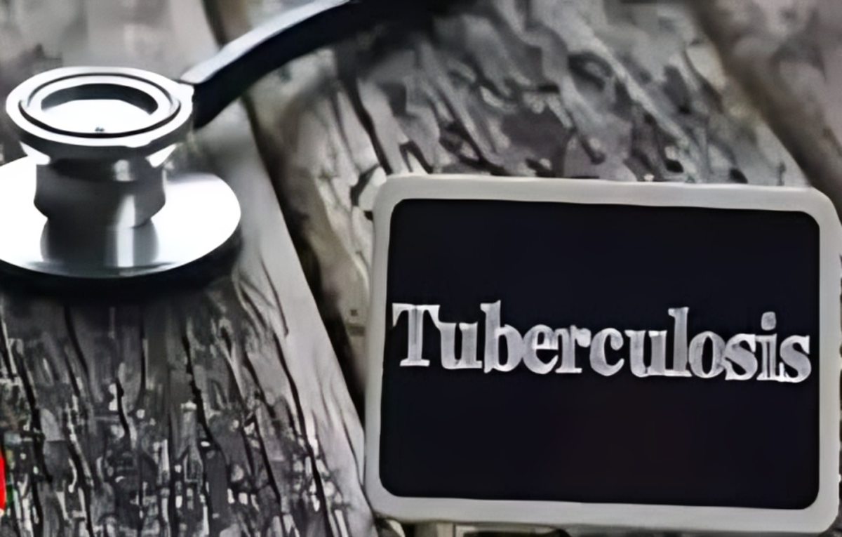 One cough too many: India’s TB fight isn’t quite there yet – ET HealthWorld