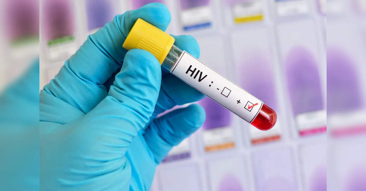 We have drugs to manage HIV. So why are we spending millions looking for cures? – ET HealthWorld