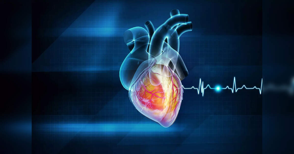 Registry to study heart attacks launched – ET HealthWorld