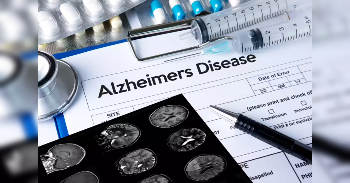 ‘Alzheimer’s can be prevented & reversed’, says expert; early intervention, natural therapies & Covid link