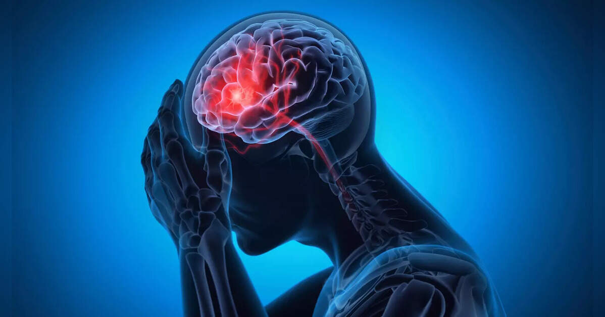 Spike in brain strokes among 40s and 50s, say doctors; stress timely diagnosis
