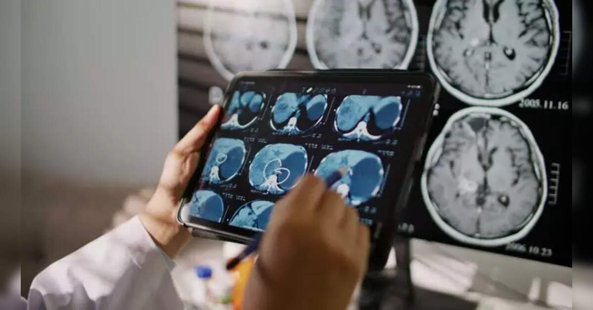 5C Network signs MoU with German Medical Innovation Co for AI-driven radiology solutions