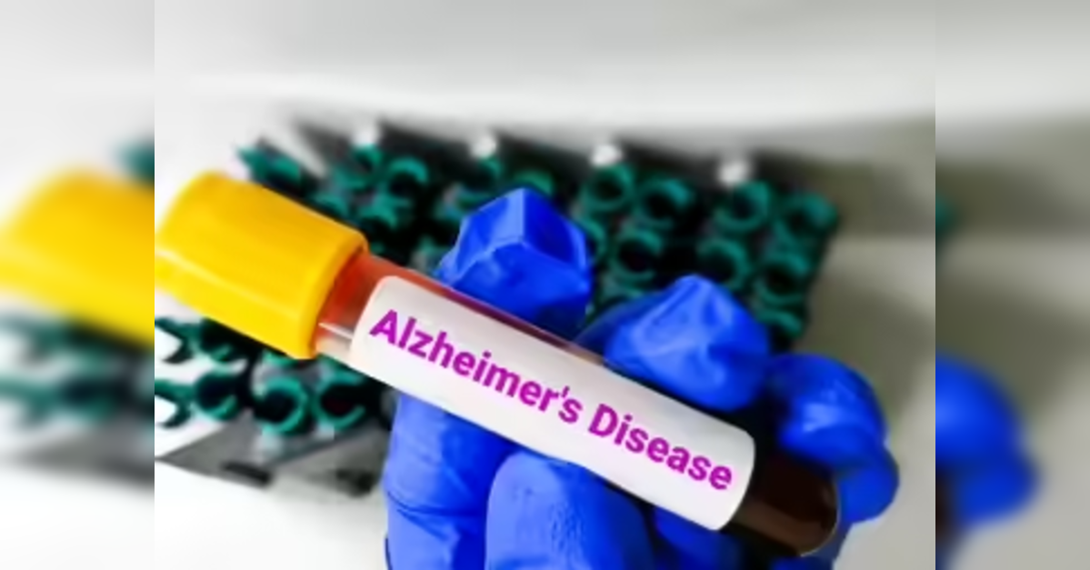 Mahajan Imaging Introduces Blood Biomarker Test