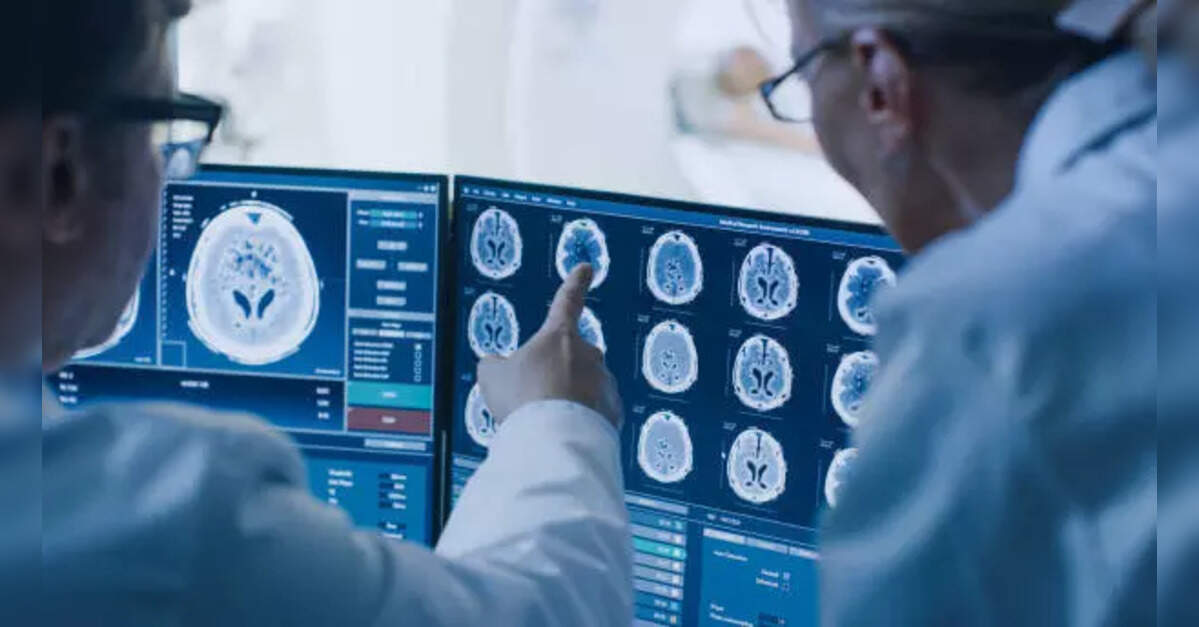 Revolutionary Study Links Gut Immune Cells to Parkinson’s Disease Progression, ETHealthworld