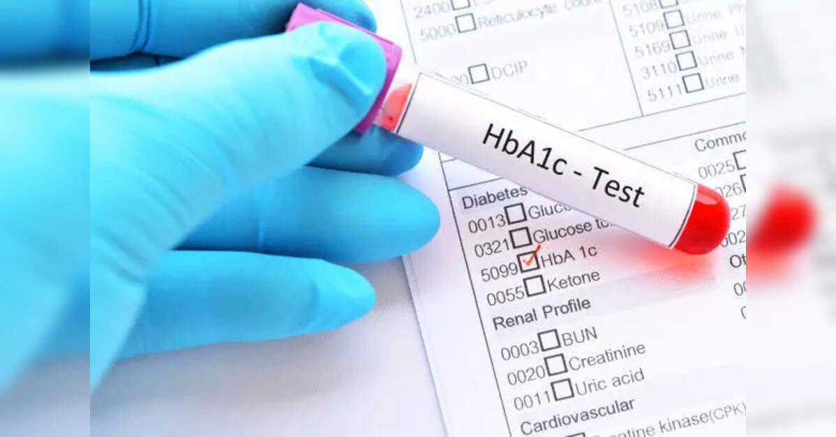 HbA1c test alone may mislead diabetes diagnosis in South Asia: Study