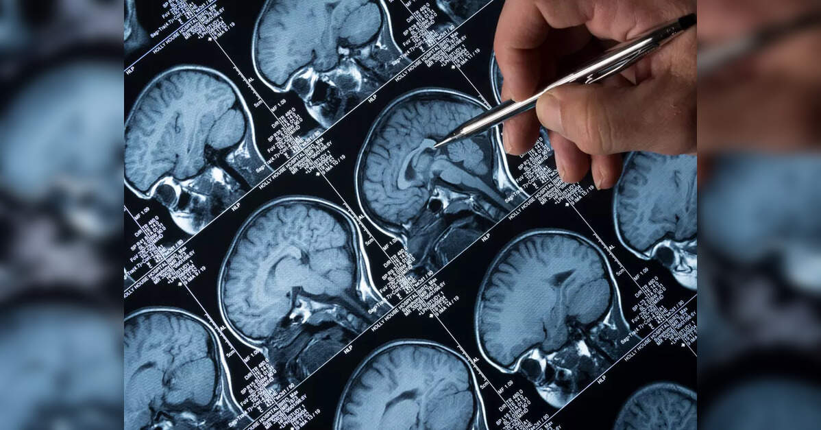 Stigma to cure: A remote Jharkhand district shows India how to fight epilepsy