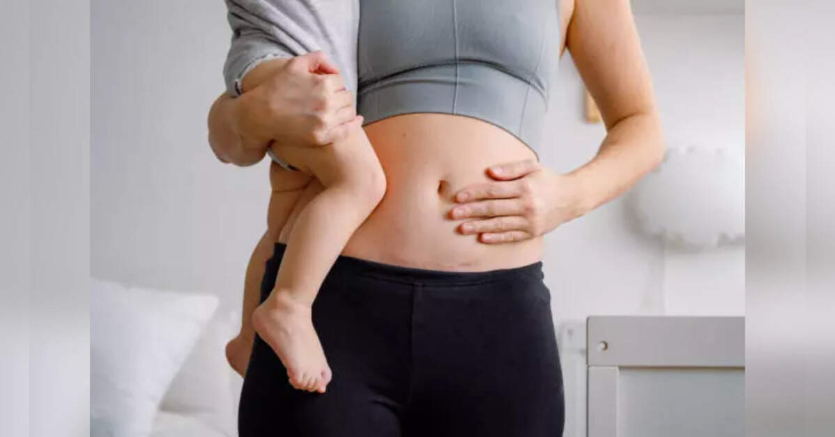 C-section births witness over four-fold rise between 2008-09 and 2024-25: Govt