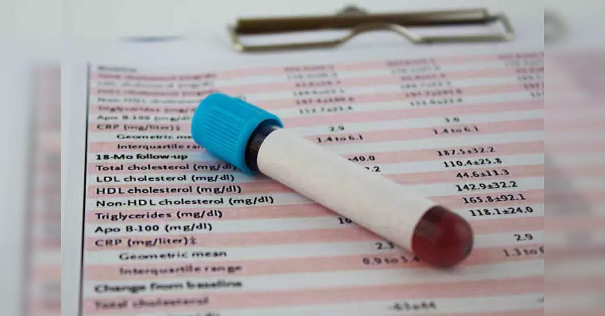 Start cholesterol checks at 19: New heart guidelines