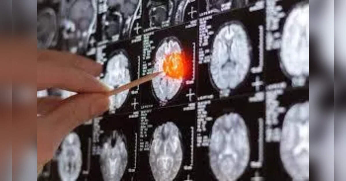 Scientists awarded £1m to develop potentially life-saving smart gel for brain cancer