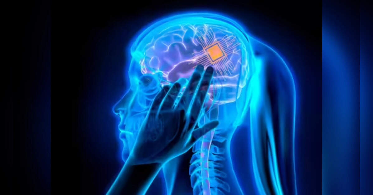 NeuCyber Neurotech Admits Three-Year Lag Behind Neuralink in Brain ...