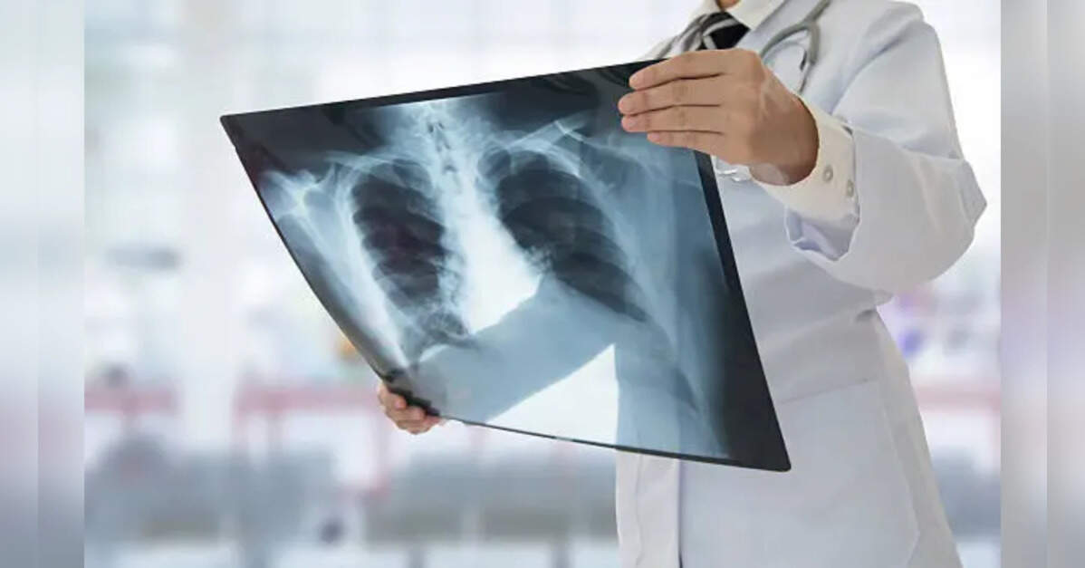 Fake X-rays created by AI fool radiologists and even AI itself