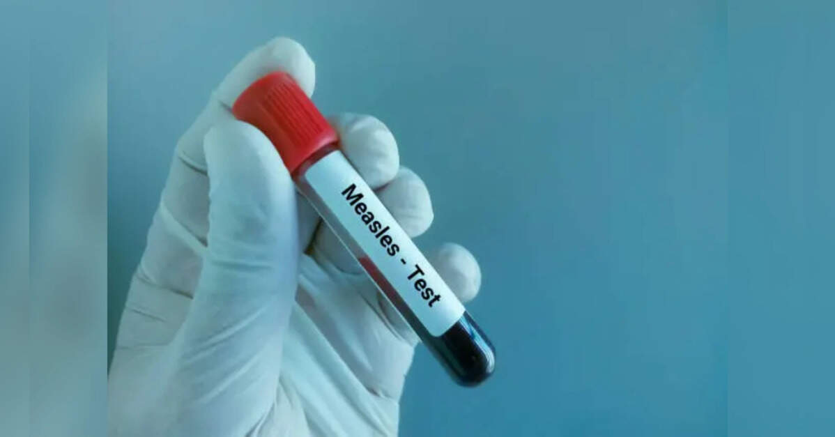 Bangladesh PM orders probe into measles outbreak